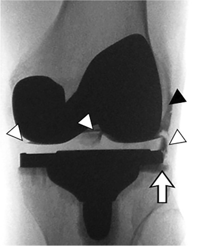 Fig. 14