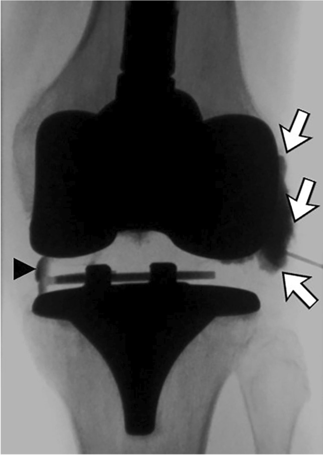 Fig. 13