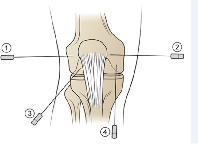 Fig. 11