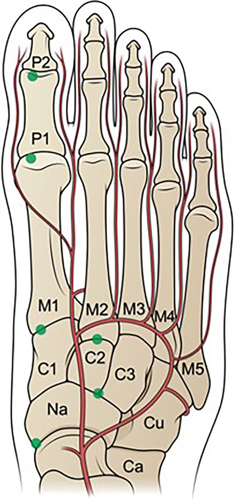 Fig. 23