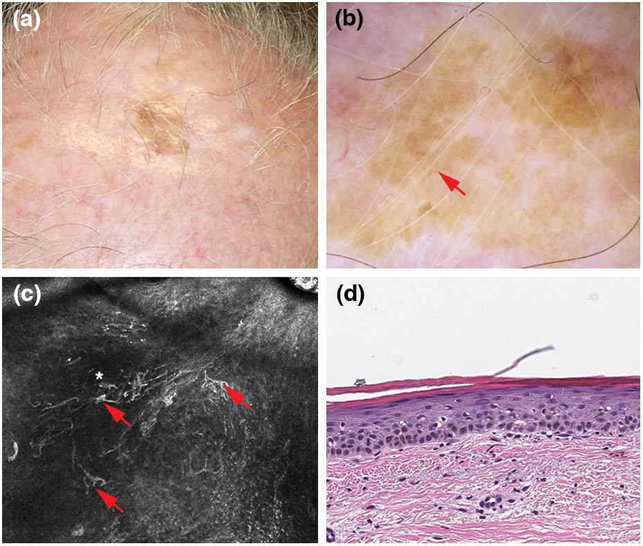 Fig 4.