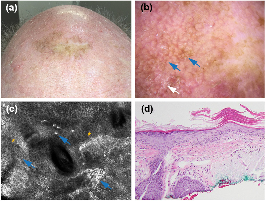 Fig 3.