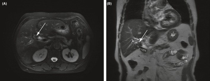 FIGURE 1