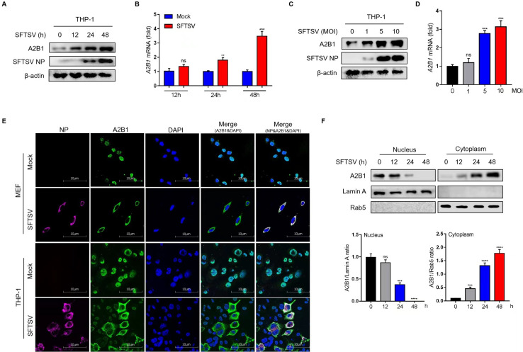 Western blot for A2B1 and NP in THP-1 cells. Bar graph of A2B1 mRNA fold change. A2B1 and NP at various MOIs. A2B1 mRNA at different MOIs. Immunofluorescence for A2B1, NP, and DAPI. A2B1 in nuclear and cytoplasmic fractions with controls.