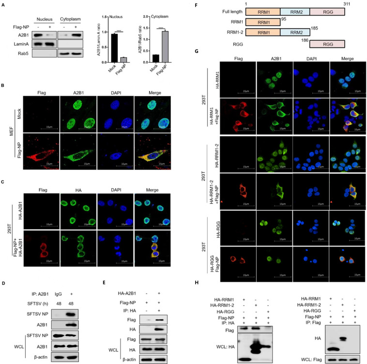 Experiments explore A2B1's role in viral processes. A2B1 and Flag-NP colocalization were observed in cells. IP confirms interaction. Specific A2B1 regions involved are depicted. Quantification of A2B1 in nucleus/cytoplasm provided.