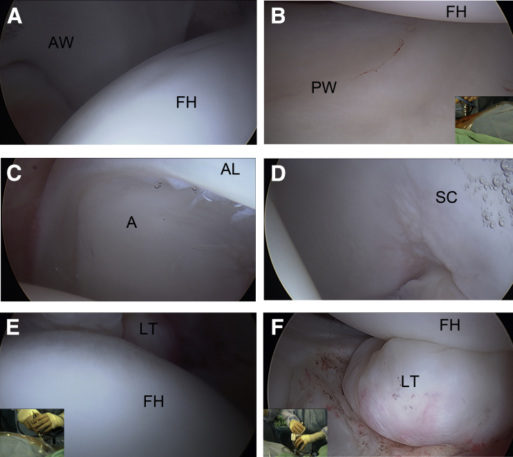 Fig 2