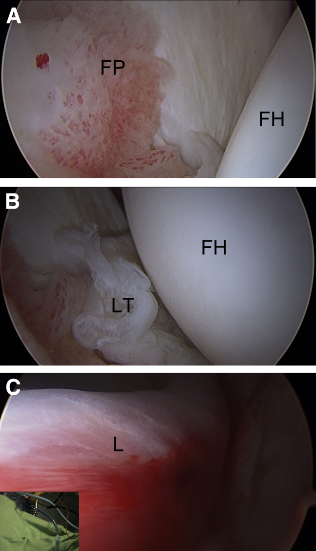 Fig 3