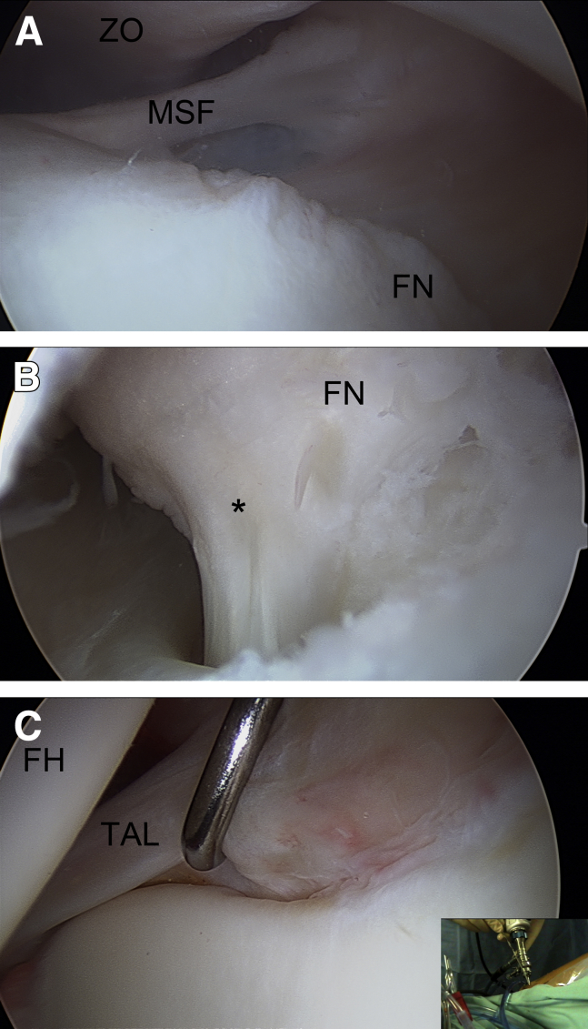 Fig 4