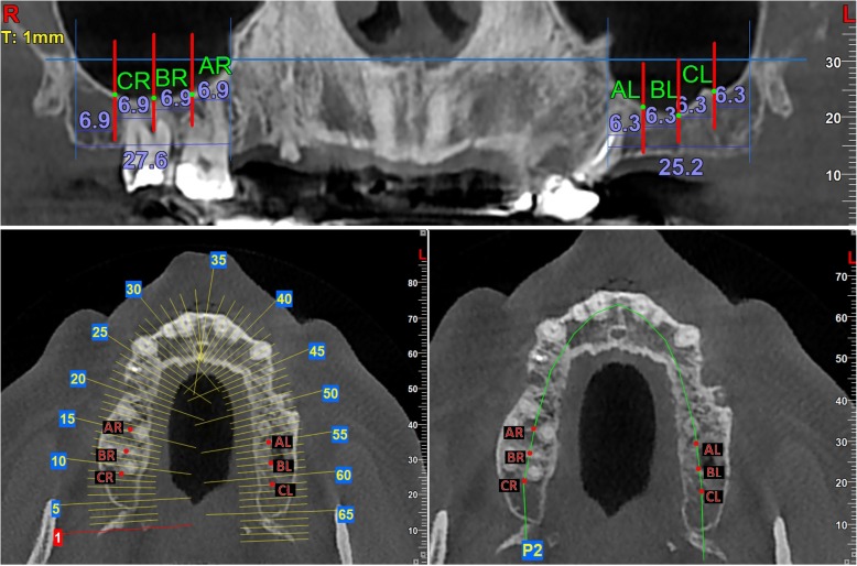 Fig. 1