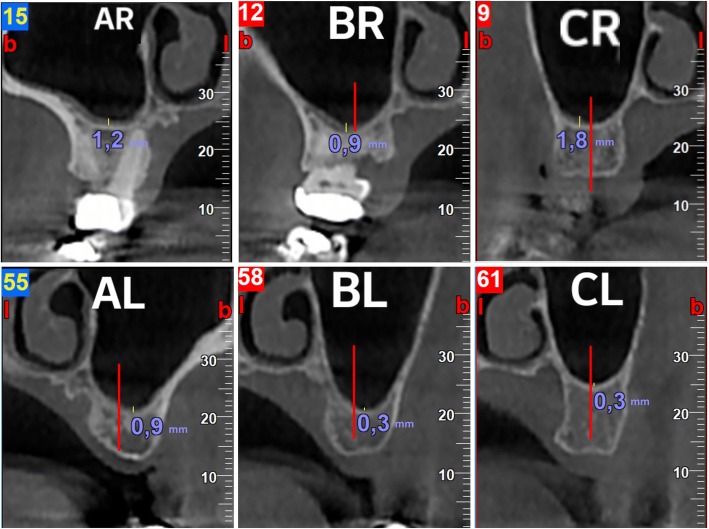 Fig. 2