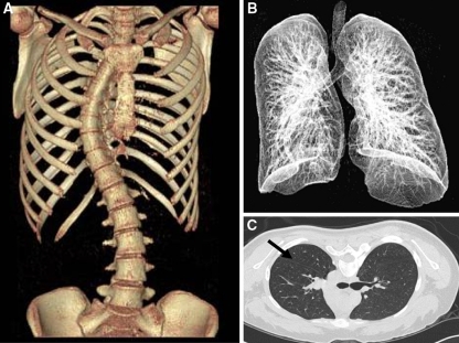 Fig. 2