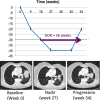 Duration of response (DOR) is defined as the time from initial response (partial or complete response) until the time of disease progression. In this example, the sum of diameters was less than 30% of baseline at week 18 (defined as partial response), and disease progression occurred at week 54. Therefore DOR was 36 weeks.