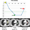 Longitudinal response categorization. At each imaging time point, the patient will receive a single categorical response. When there is a partial treatment response (PR), the time point with the smallest tumor burden is the nadir (green arrow). Provided there are no changes in nontarget lesions and no new lesions, when the smallest tumor burden increases by more than 20% from nadir (or baseline [yellow arrow], if no nadir), this is the date of disease progression (PD) (red arrow). Lines on bottom images indicate tumor diameter.