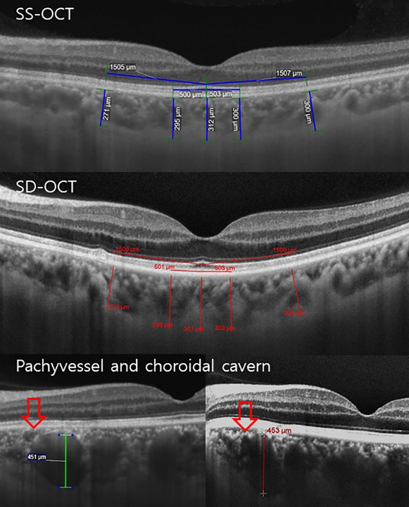 Fig 1