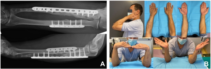 Fig. 3