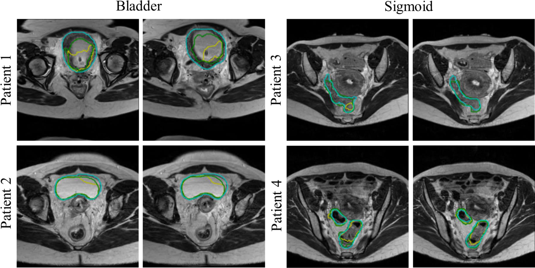 Fig. 9.