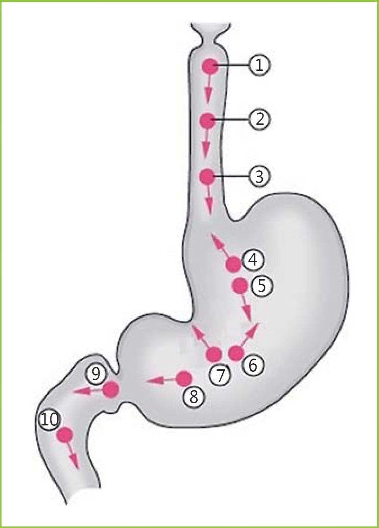 Fig. 1