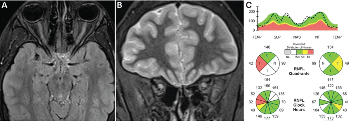 FIGURE 3–4