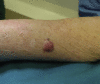 Fig 1