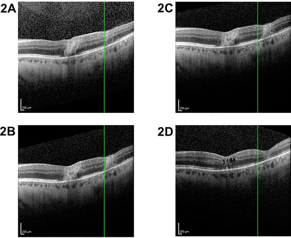 Figure 2: