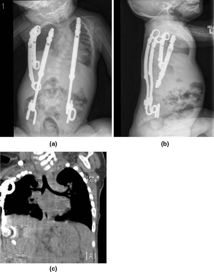 Fig. 4