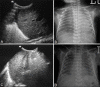 Figure 4(A-D)