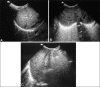 Figure 1(A-C)