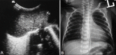 Figure 2(A, B)