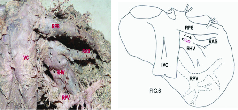 [Table/Fig-6]: