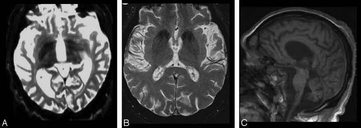 Fig 8.