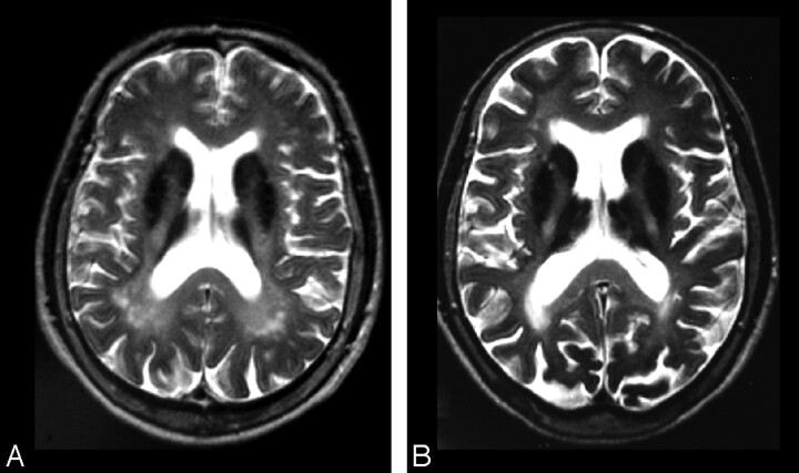 Fig 6.