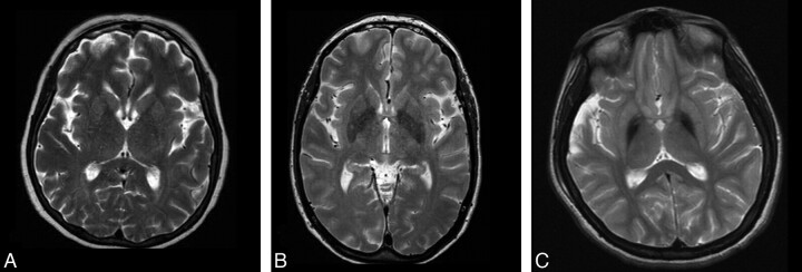 Fig 1.