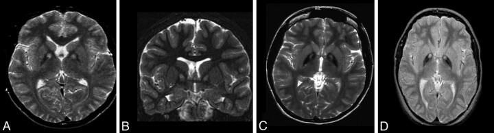 Fig 3.