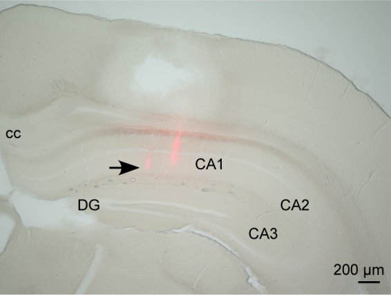 Figure 4—figure supplement 2.