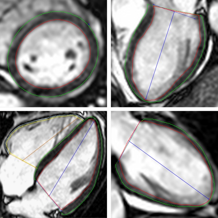 Figure 2