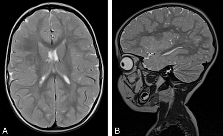 Fig 3.