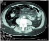 Fig. 2.