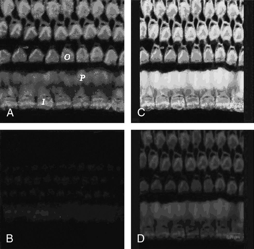 FIG. 1