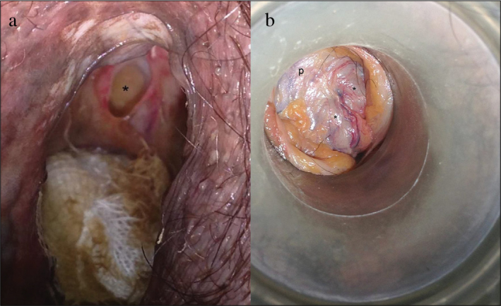 Figure 1. a, b.