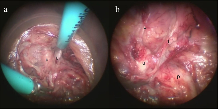 Figure 3. a, b.