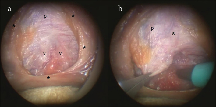 Figure 2. a, b.