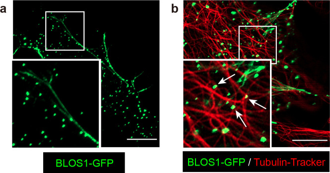 Figure 7—figure supplement 1.