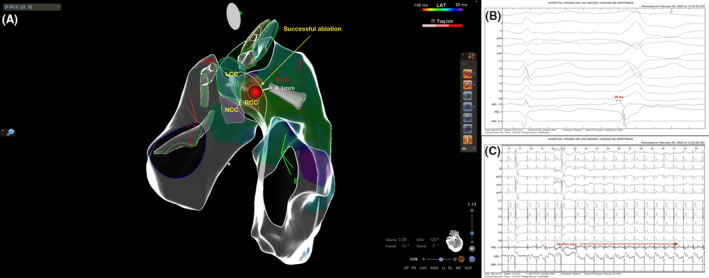 FIGURE 3