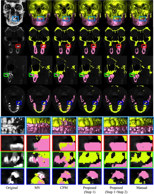 Figure 12