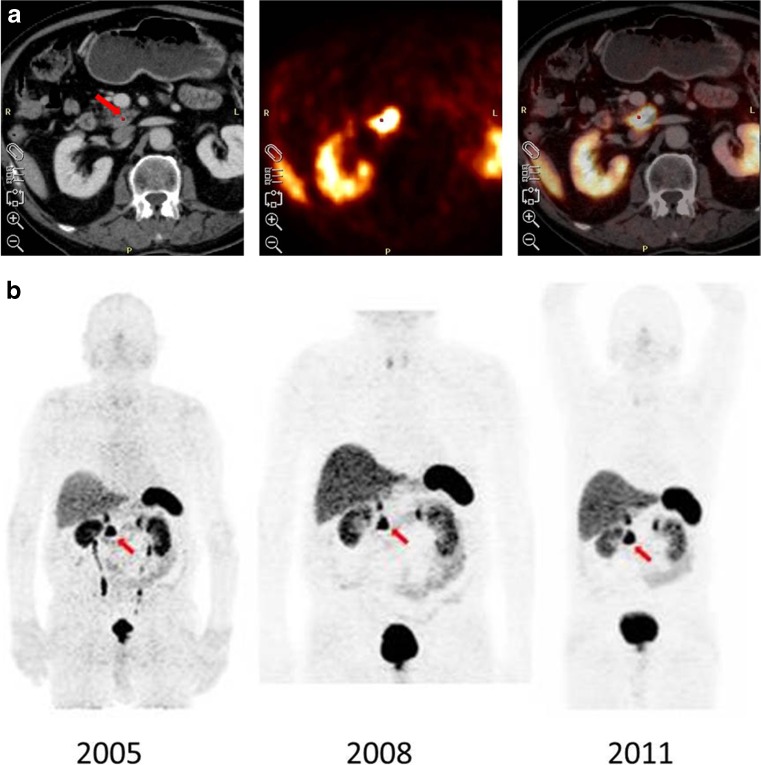 Fig. 3