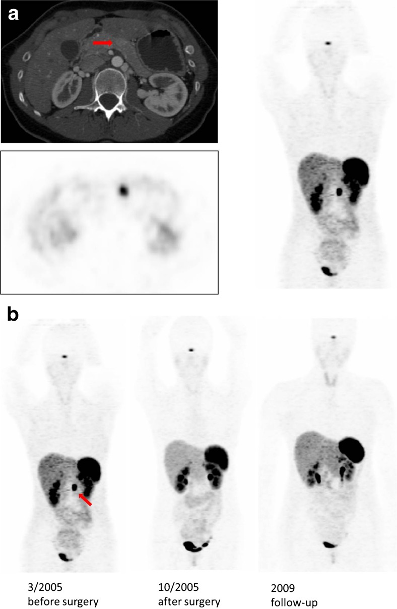 Fig. 4