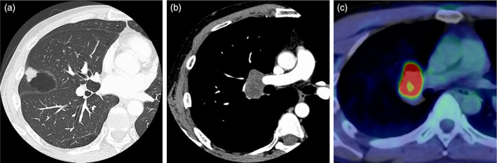 FIGURE 1