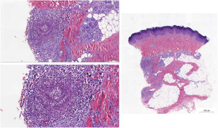 Fig. 2