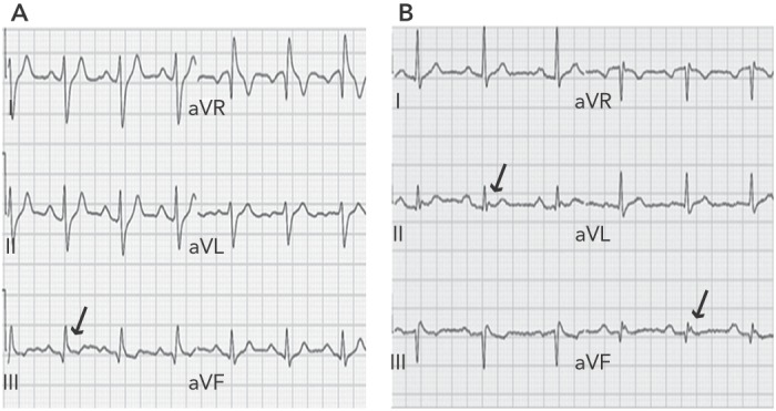 Figure 1: