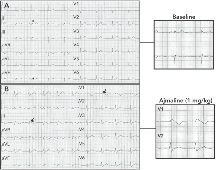 Figure 2: